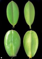 Veronica elliptica. Leaf surfaces, adaxial (left) and abaxial (right). Ōkarito, Westland (above) and Titahi Bay, Wellington (below). Scale = 1 mm.
 Image: W.M. Malcolm © Te Papa CC-BY-NC 3.0 NZ